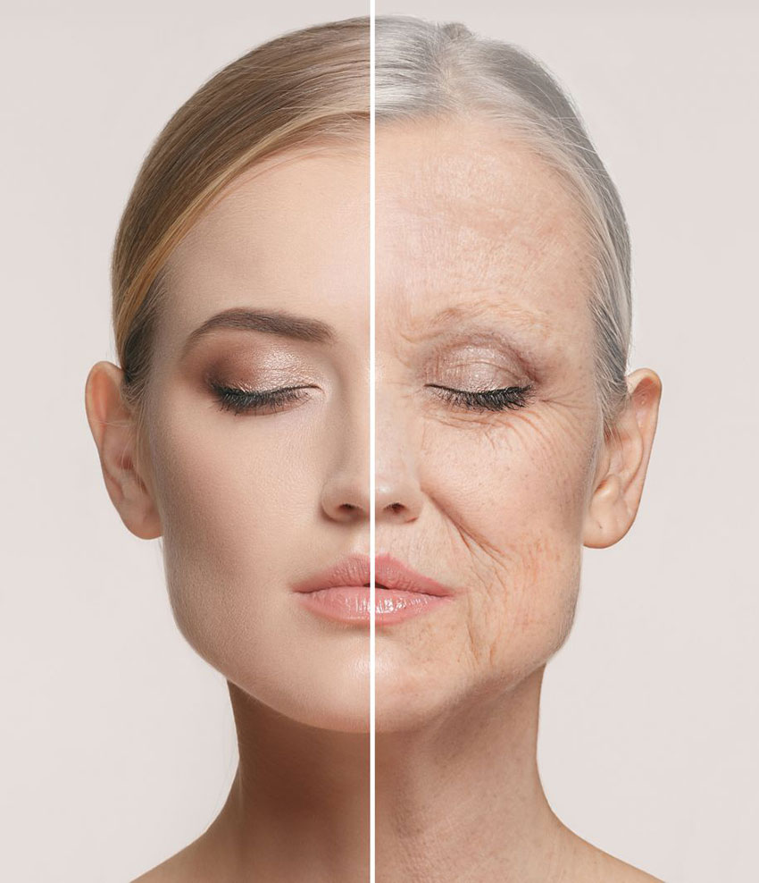 Forms of facial aging 